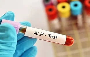 Alkaline Phosphatase (ALP)