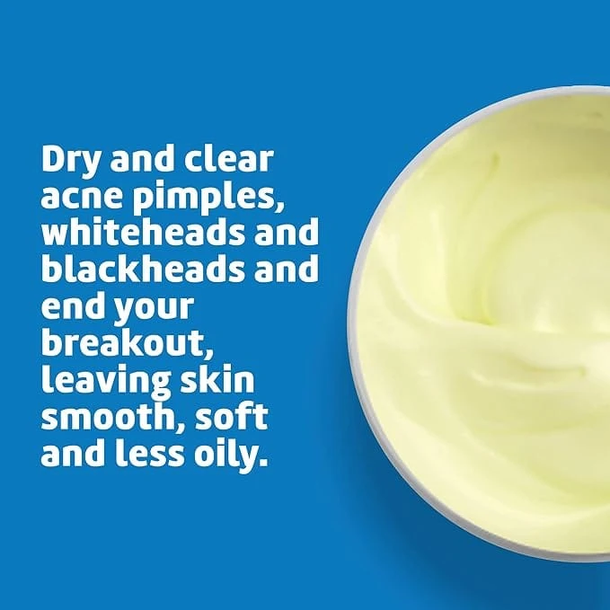De La Cruz Sulfur Ointment Cystic Acne Treatment for Face and Body Daily 10 Min Spot Treatment Mask Safe and Effective Game Changing Hormonal Acne Treatment that Clears Up Pimples 0.21oz 6g