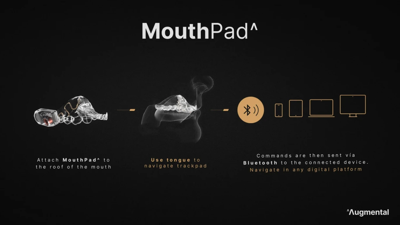 MouthPad